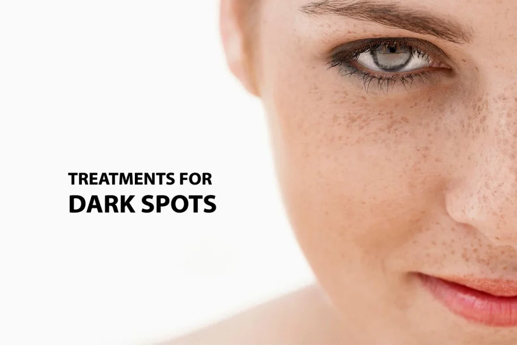 درمان لک های پوستی