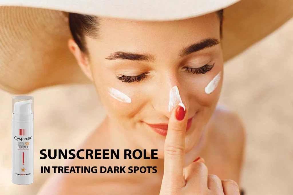 نقش ضد آفتاب در درمان لک