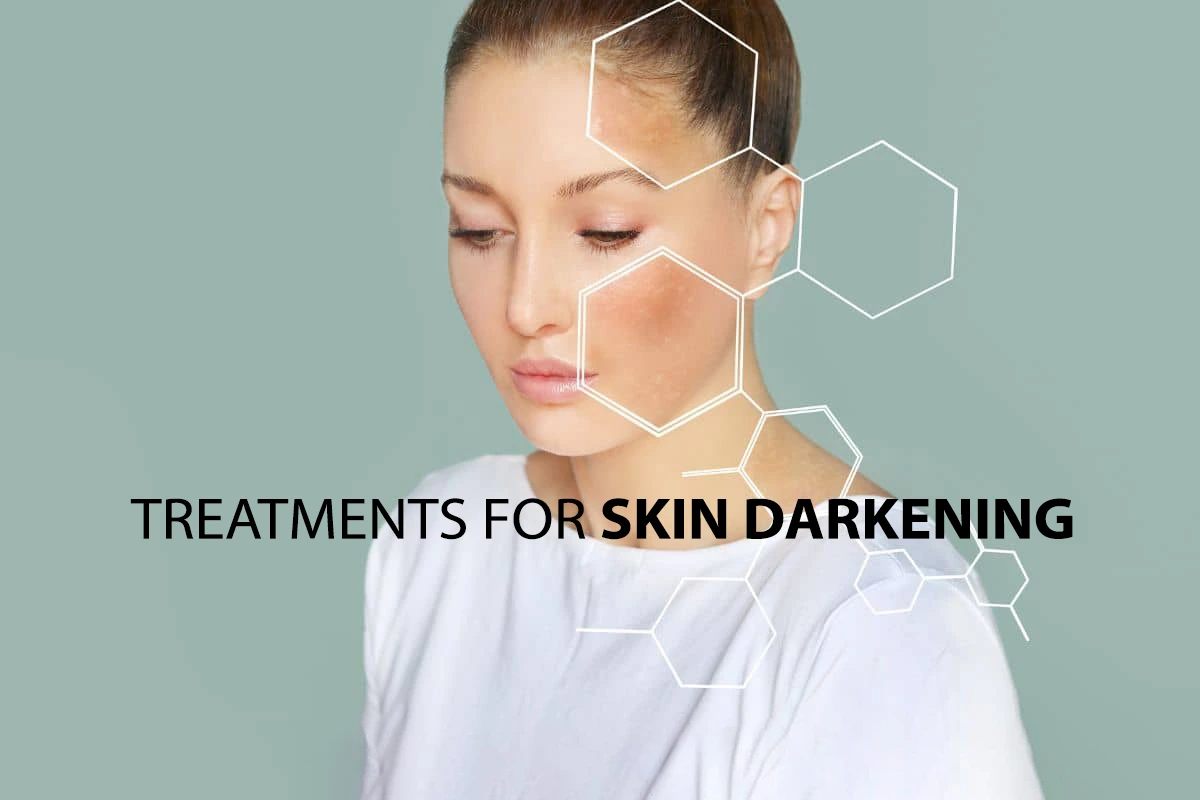 درمان تیرگی پوست چیست؟