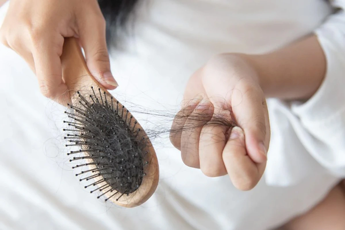 علت ریزش مو در بارداری و ریزش موی هورمونی