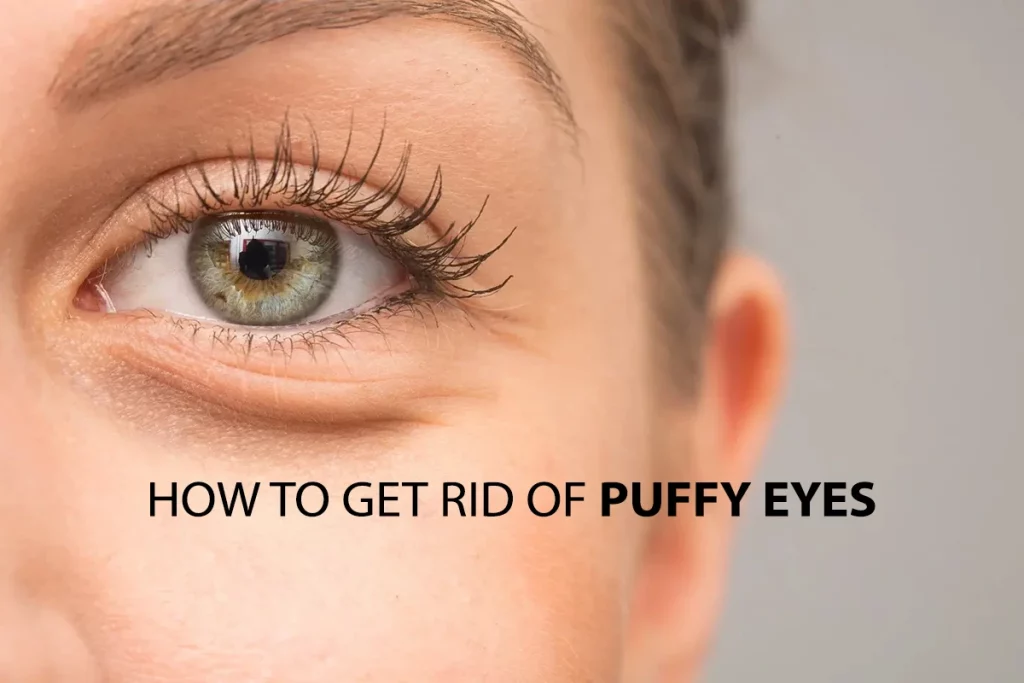 درمان پف چشم چیست؟