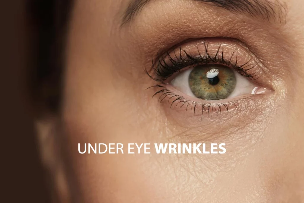 معرفی بهترین کرم ضد چروک چشم