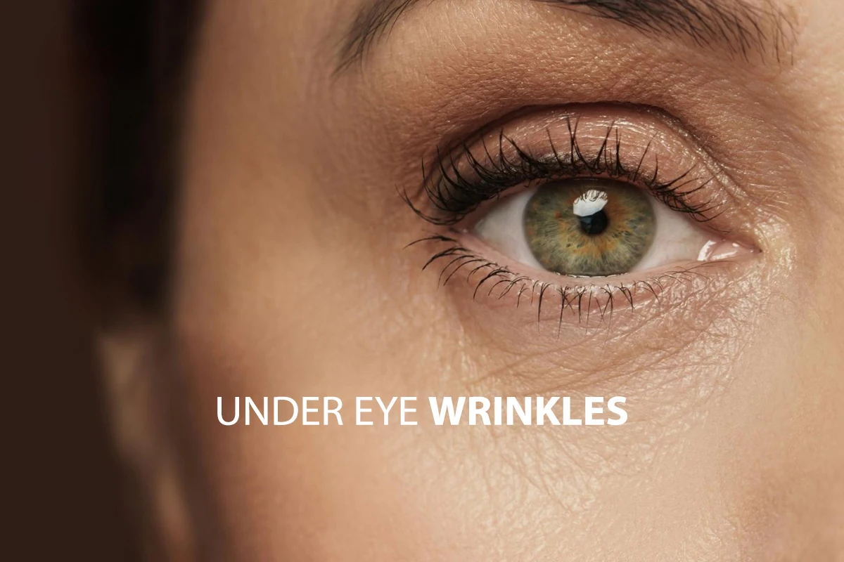 معرفی بهترین کرم ضد چروک چشم